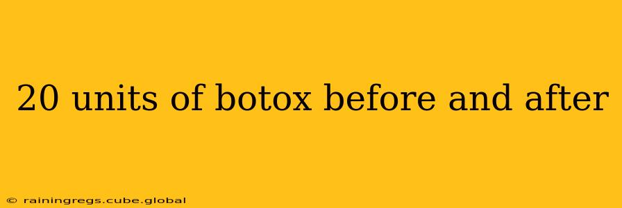 20 units of botox before and after