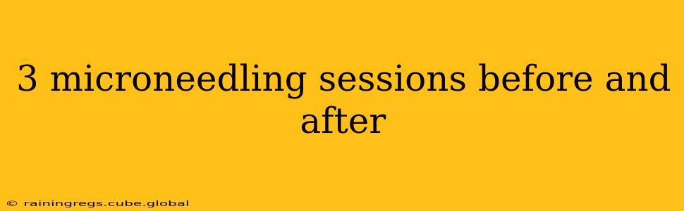 3 microneedling sessions before and after