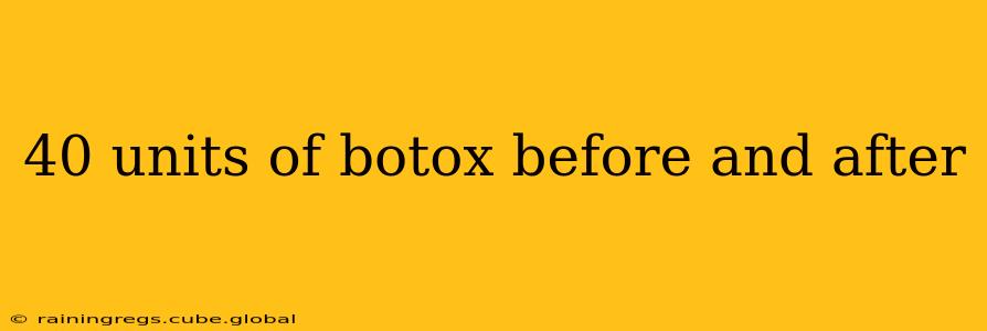 40 units of botox before and after