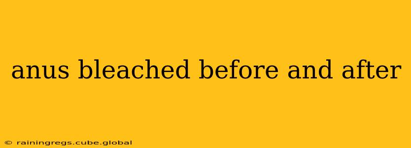 anus bleached before and after