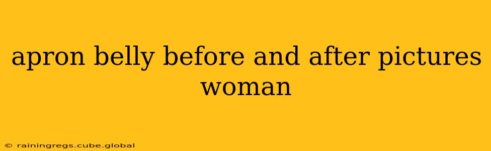 apron belly before and after pictures woman