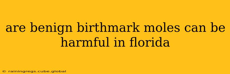 are benign birthmark moles can be harmful in florida