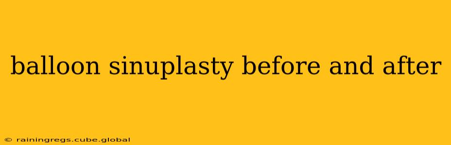 balloon sinuplasty before and after