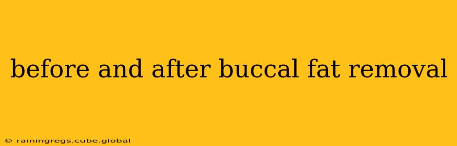 before and after buccal fat removal