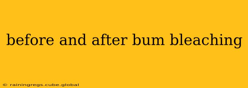 before and after bum bleaching