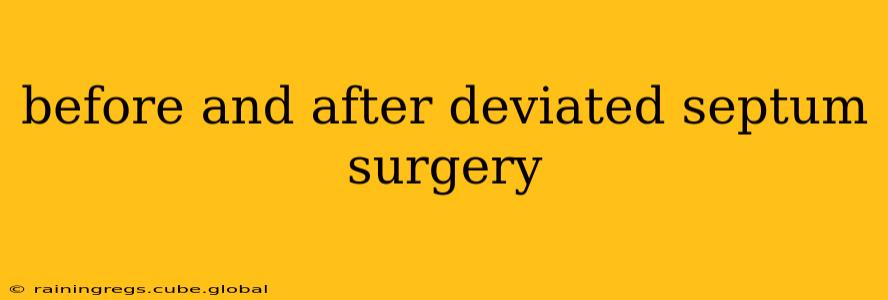 before and after deviated septum surgery
