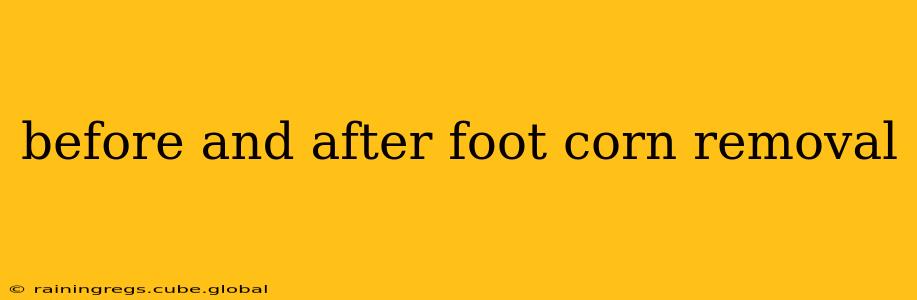 before and after foot corn removal