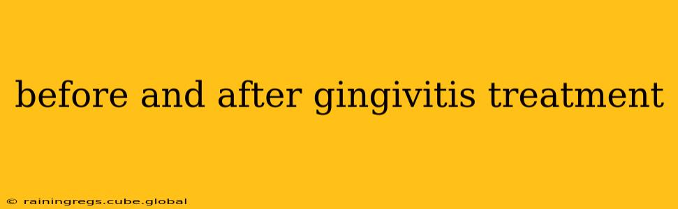 before and after gingivitis treatment