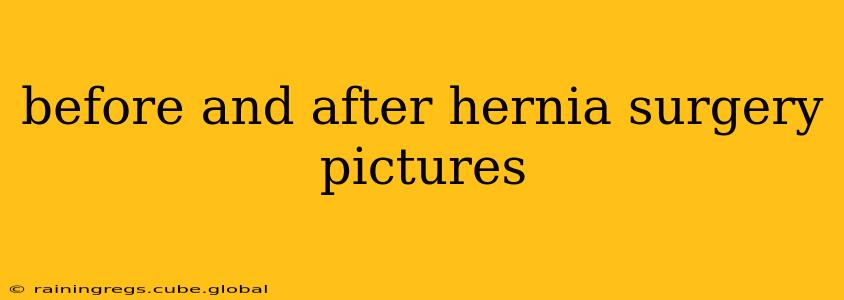 before and after hernia surgery pictures