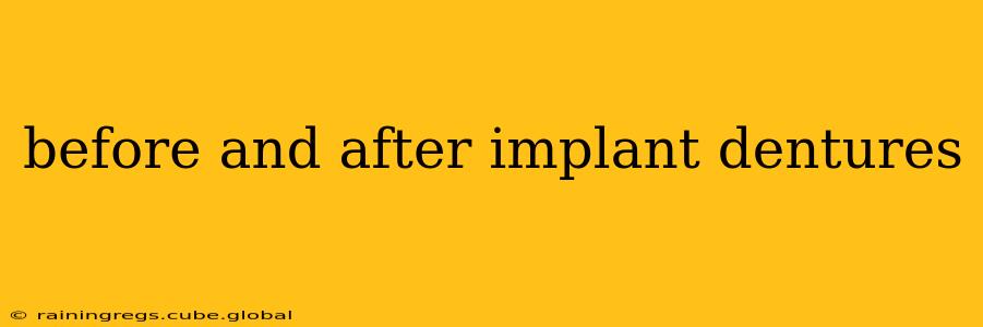 before and after implant dentures