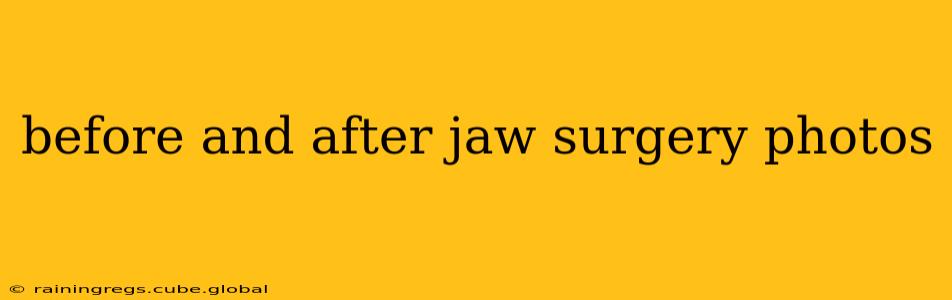 before and after jaw surgery photos