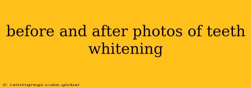 before and after photos of teeth whitening