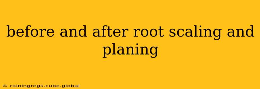 before and after root scaling and planing