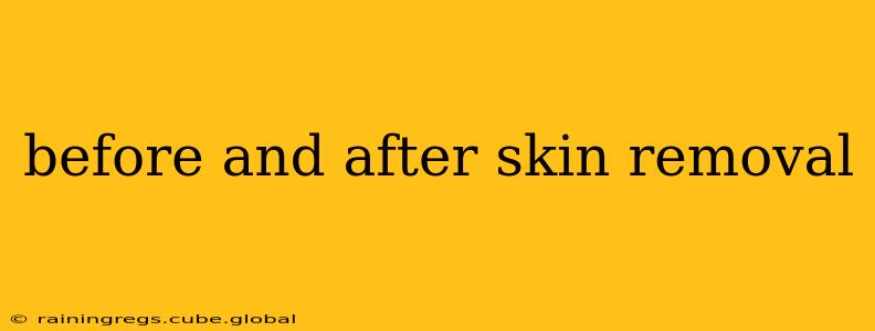before and after skin removal