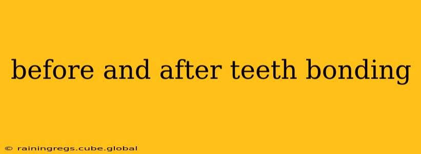 before and after teeth bonding