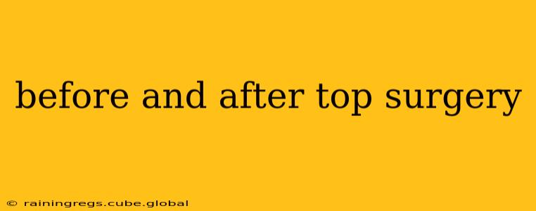 before and after top surgery