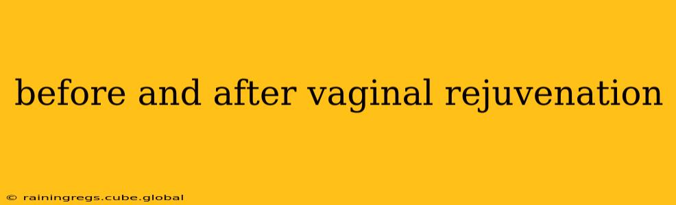 before and after vaginal rejuvenation