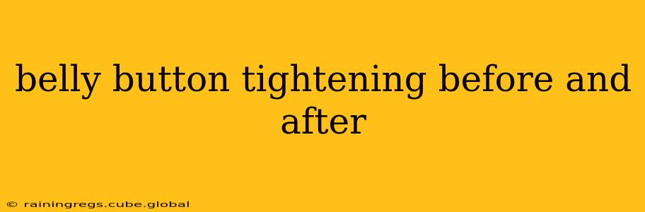 belly button tightening before and after