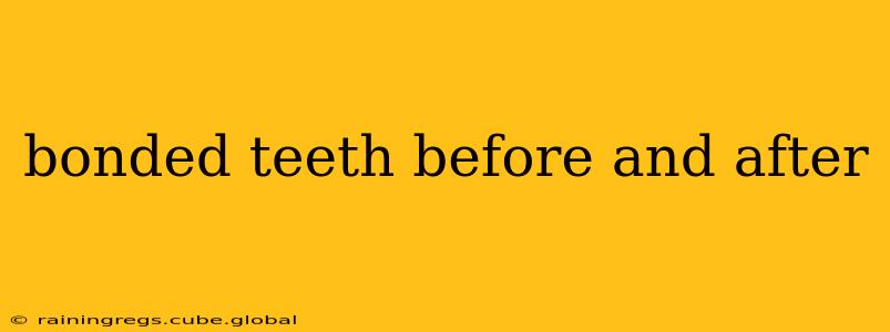 bonded teeth before and after