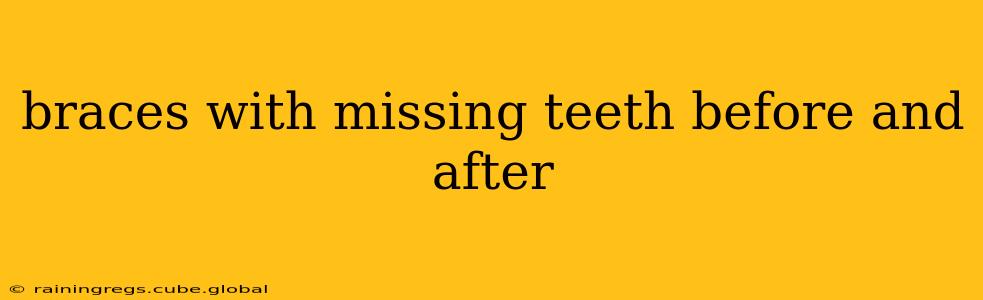 braces with missing teeth before and after