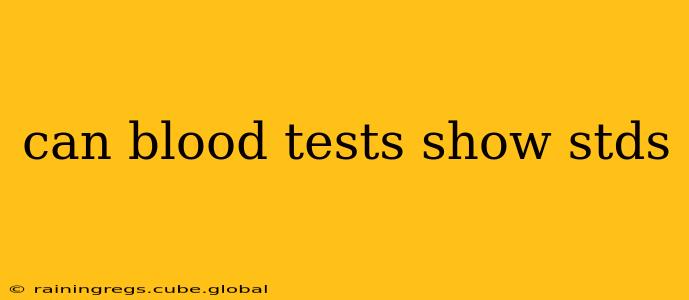 can blood tests show stds