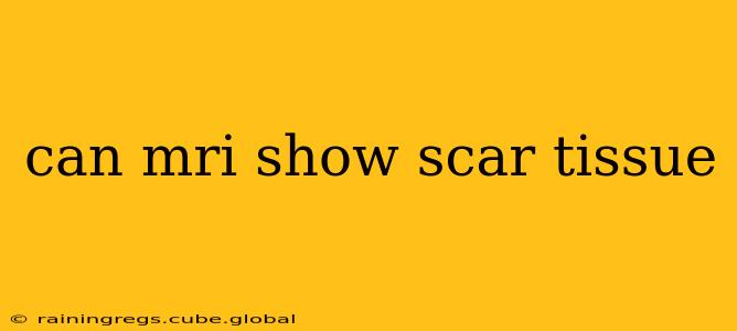 can mri show scar tissue