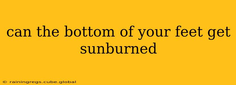 can the bottom of your feet get sunburned