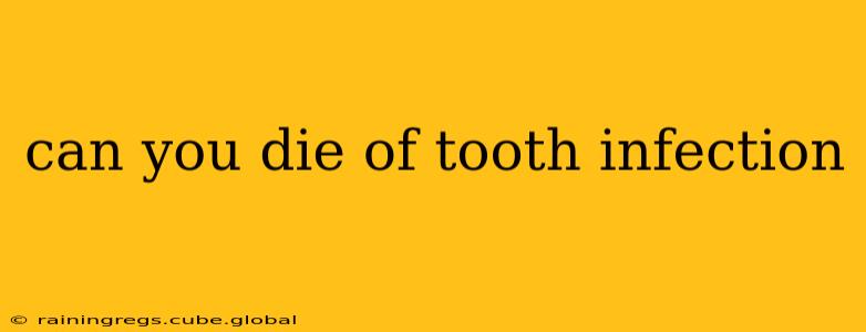 can you die of tooth infection