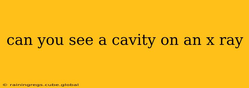 can you see a cavity on an x ray