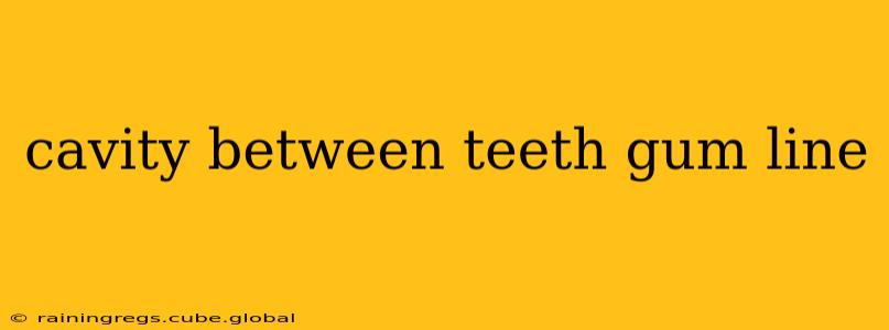 cavity between teeth gum line