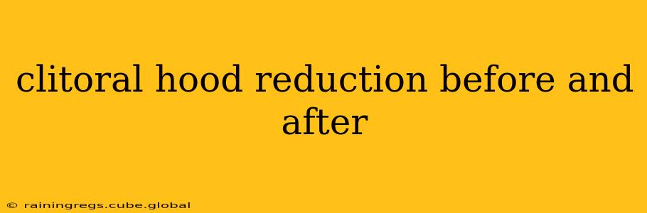 clitoral hood reduction before and after