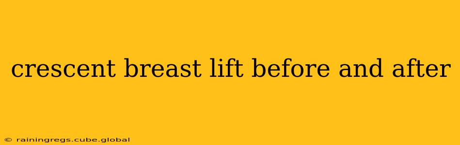 crescent breast lift before and after