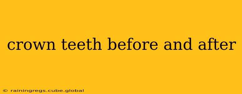 crown teeth before and after