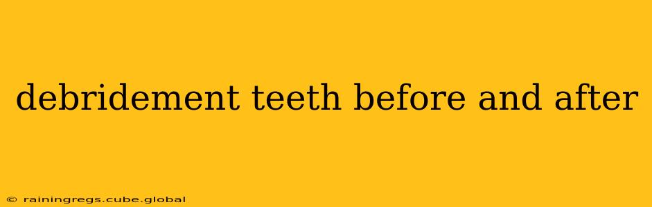debridement teeth before and after