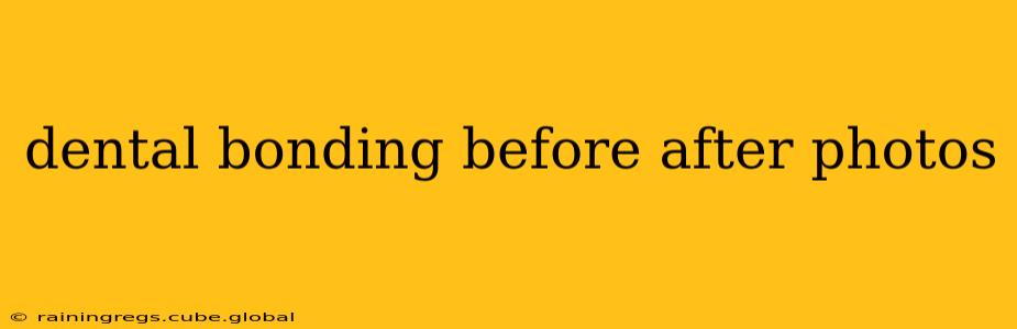 dental bonding before after photos