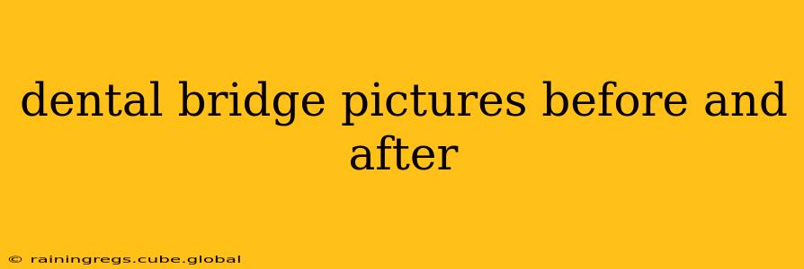 dental bridge pictures before and after