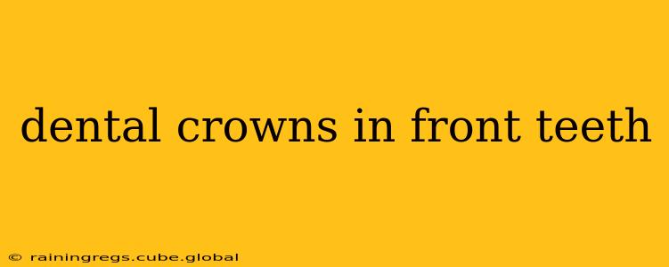 dental crowns in front teeth