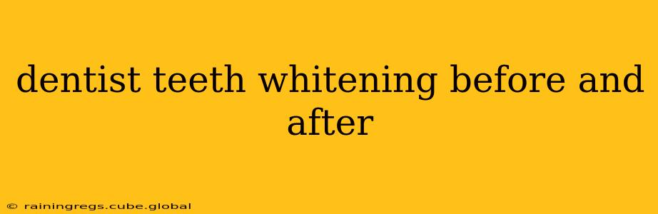 dentist teeth whitening before and after