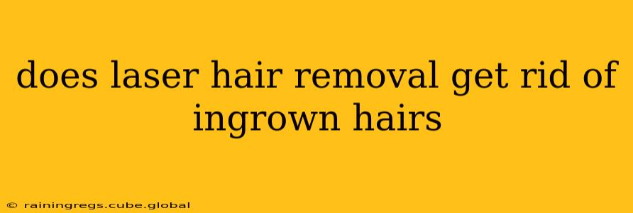 does laser hair removal get rid of ingrown hairs