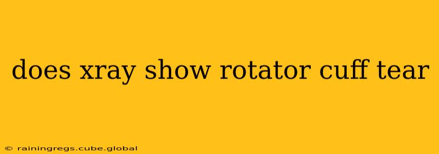 does xray show rotator cuff tear