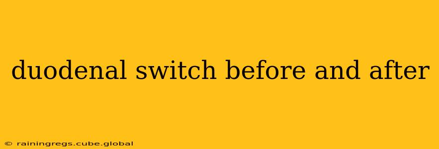 duodenal switch before and after