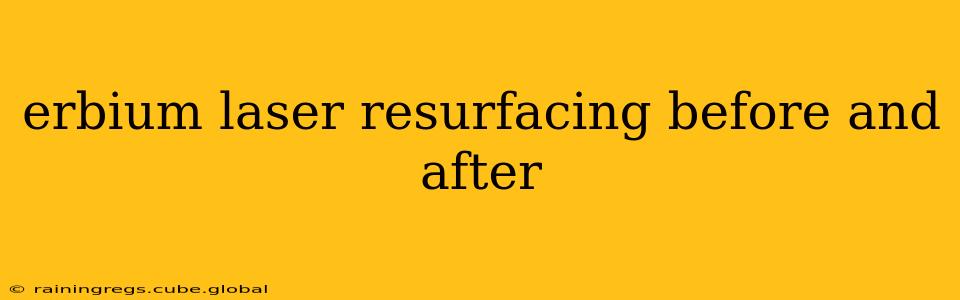 erbium laser resurfacing before and after