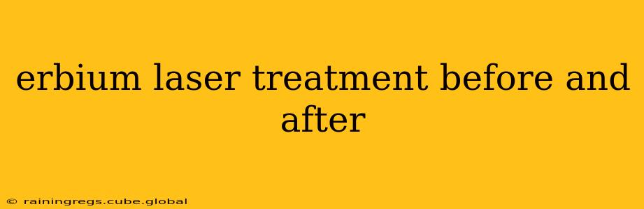 erbium laser treatment before and after