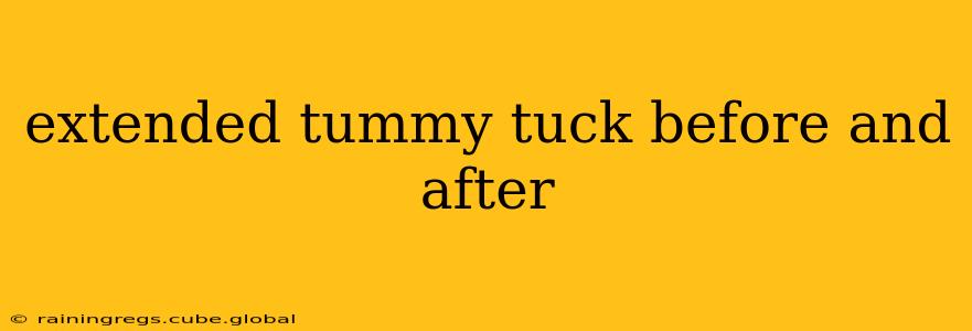 extended tummy tuck before and after