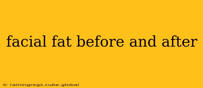 facial fat before and after