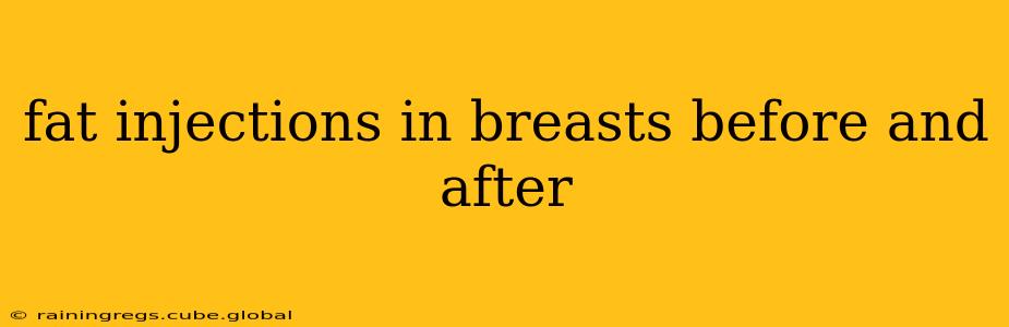 fat injections in breasts before and after