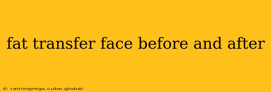 fat transfer face before and after