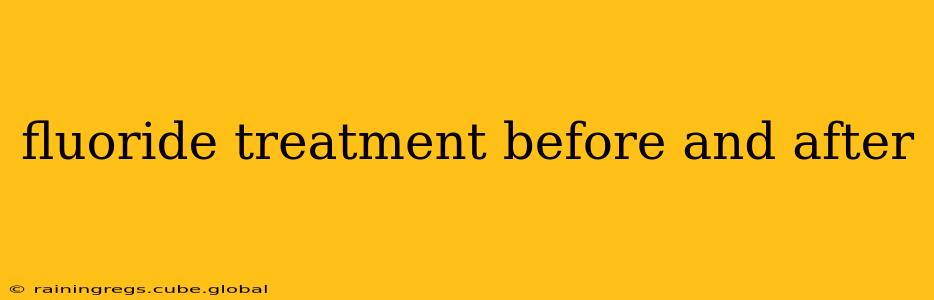 fluoride treatment before and after