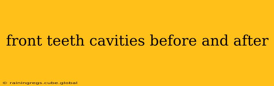 front teeth cavities before and after