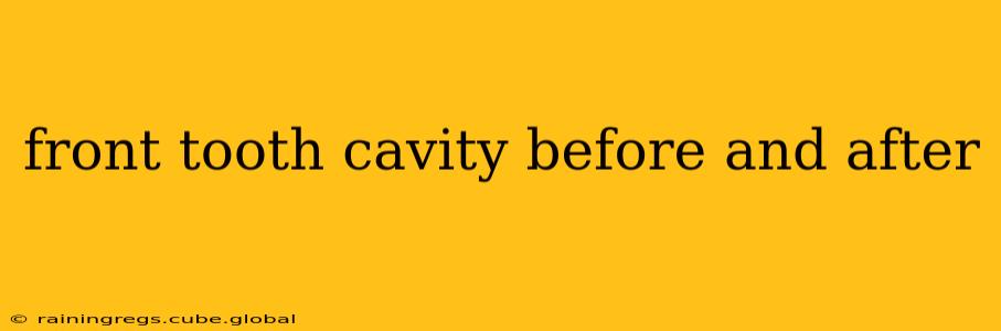 front tooth cavity before and after